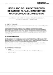 Rotulado de las extensiones de sangre para el diagnóstico microscópico del paludismo